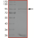 EGFR (d746-750 T790M C797G) Protein